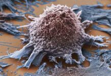 Muchos medicamentos contra el cáncer apuntan a objetivos moleculares incorrectos Muchos medicamentos contra el cáncer apuntan a objetivos moleculares incorrectos