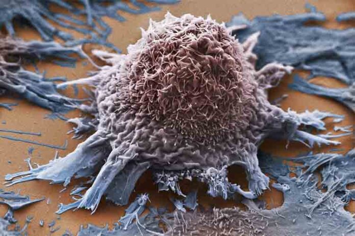 Muchos medicamentos contra el cáncer apuntan a objetivos moleculares incorrectos