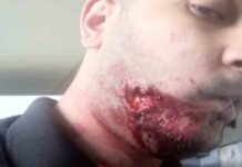 Detenido un hombre por morder a un vigilante del Metro en Barcelona Detenido un hombre por morder a un vigilante del Metro en Barcelona