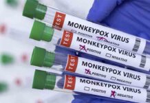 LA OMS declara la viruela del mono como emergencia de salud pública España ya tiene 98 casos de viruela del mono, el país con la cifra más alta