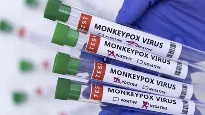 España ya tiene 98 casos de viruela del mono, el país con la cifra más alta