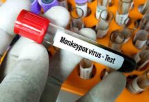 Sanidad eleva a 186 los casos detectados de viruela del mono en España Sanidad eleva a 186 los casos detectados de viruela del mono en España