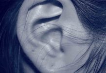 ¿Qué saber sobre la otoplastia? ¿Qué saber sobre la otoplastia?