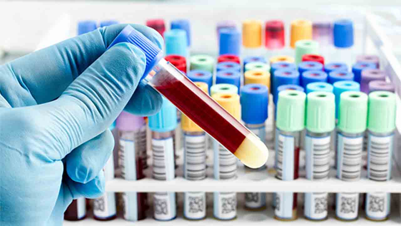 Impulso al primer test sanguíneo con valor pronóstico para el Alzheimer